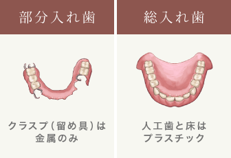 部分入れ歯/総入れ歯