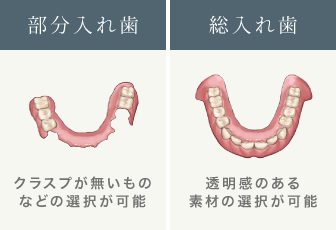 部分入れ歯/総入れ歯